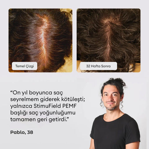 StimuField™ PEMF Teknolojili Saç Güçlendirme Şapkası